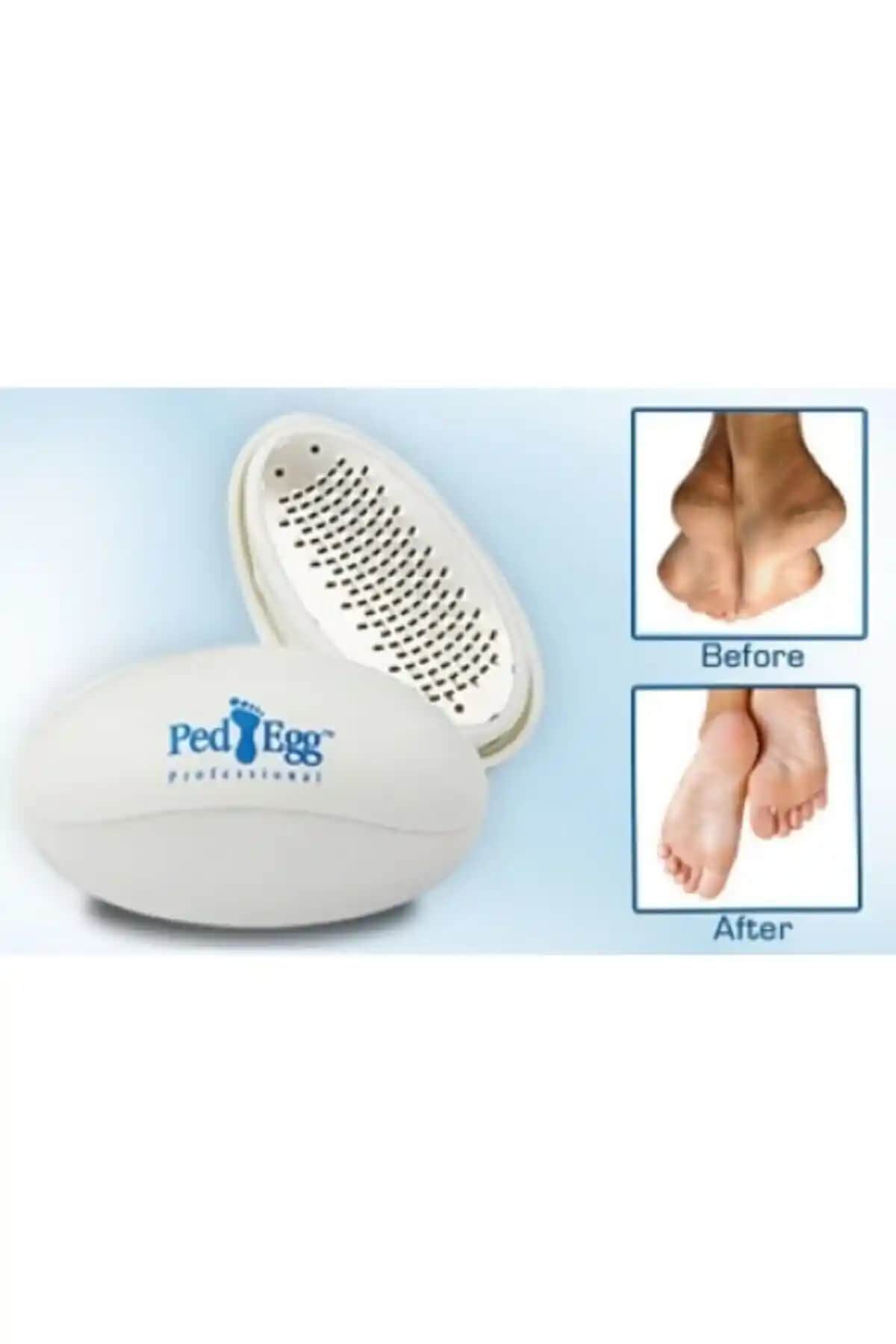 CMT Ped Egg Topuk Törpüsü ile Ayak Bakımında Etkili ve Pratik Çözüm